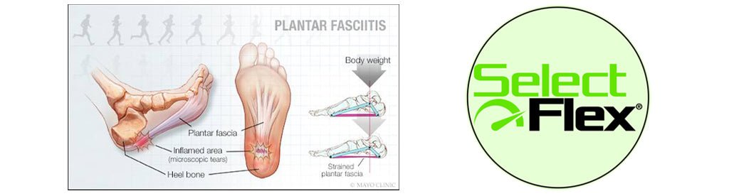 Best 6 Ways to Reduce Pain From Plantar Fasciitis - SelectFlex
