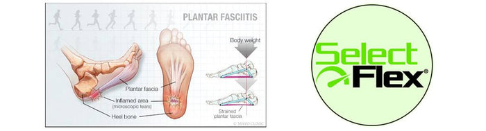 Best 6 Ways to Reduce Pain From Plantar Fasciitis - SelectFlex