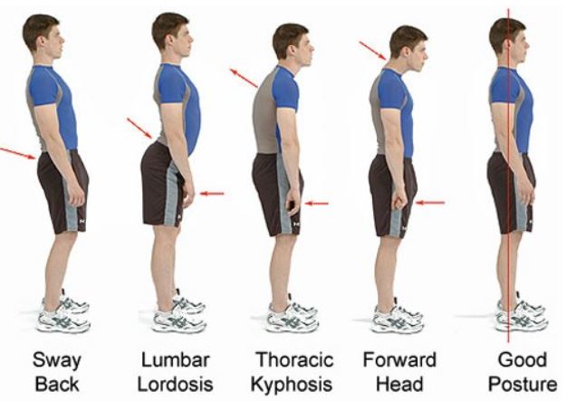 HOW DYNAMIC ARCH SUPPORT CORRECTS ALIGNMENT & POSTURE - SelectFlex