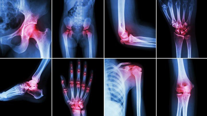HOW TO STOP JOINT PAIN - SelectFlex