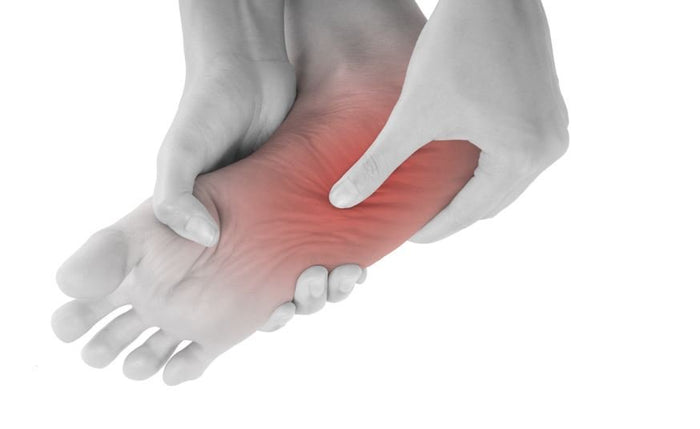 Pain in Arch of Foot: Causes, Treatments & Stretches - SelectFlex